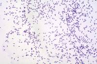 Oursin - Spermatozoïdes après coloration x100